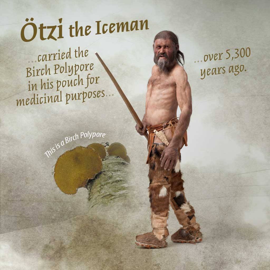 Otzi the Iceman and Birch Polypore
